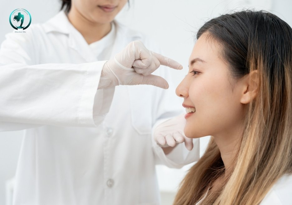 Nâng mũi bán cấu trúc