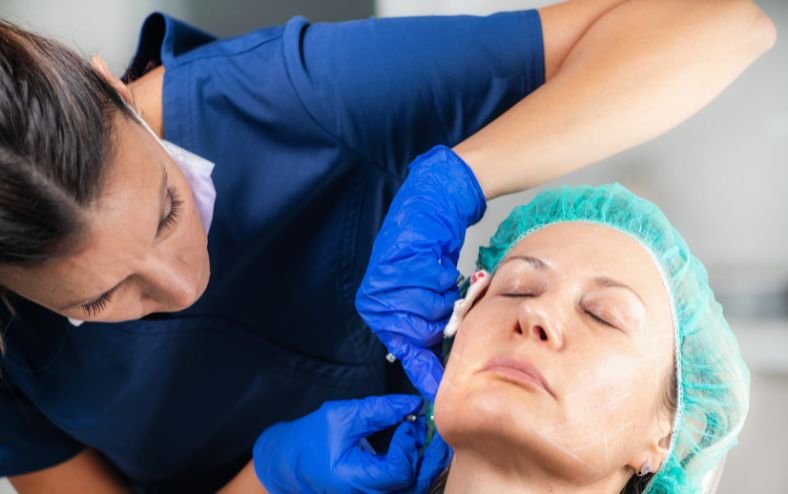 Căng da mặt bằng chỉ collagen