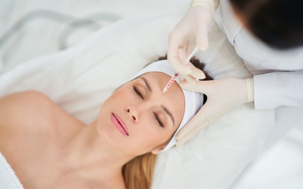 căng da mặt bằng chỉ collagen